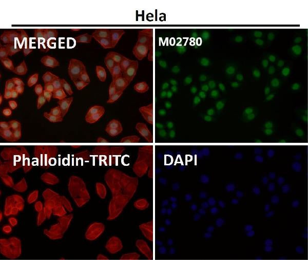 1 - Anti-HP1 alpha CBX5 Rabbit Monoclonal Antibody ABO13970