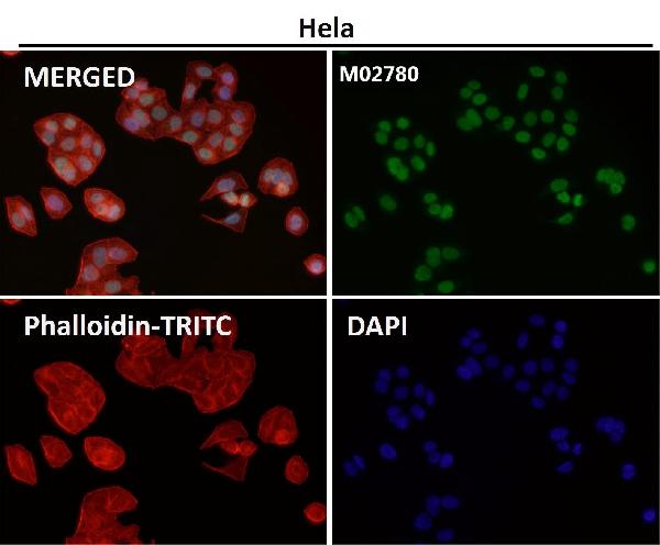 1 - Anti-HP1 alpha CBX5 Rabbit Monoclonal Antibody ABO13970
