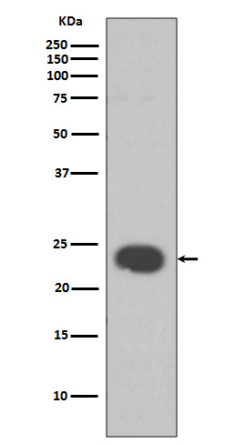 1 - Anti-HP1 alpha CBX5 Rabbit Monoclonal Antibody ABO13970