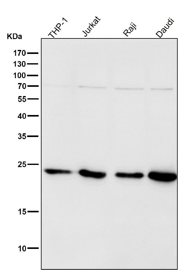 1 - Anti-HP1 alpha CBX5 Rabbit Monoclonal Antibody ABO13970