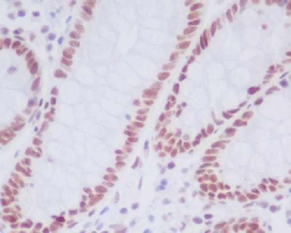 2 - Anti-KDM1/LSD1 KDM1A Rabbit Monoclonal Antibody ABO13971