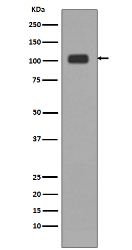 1 - Anti-KDM1/LSD1 KDM1A Rabbit Monoclonal Antibody ABO13971