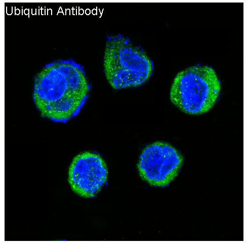 3 - Anti-Ubiquitin UBB Rabbit Monoclonal Antibody ABO13972
