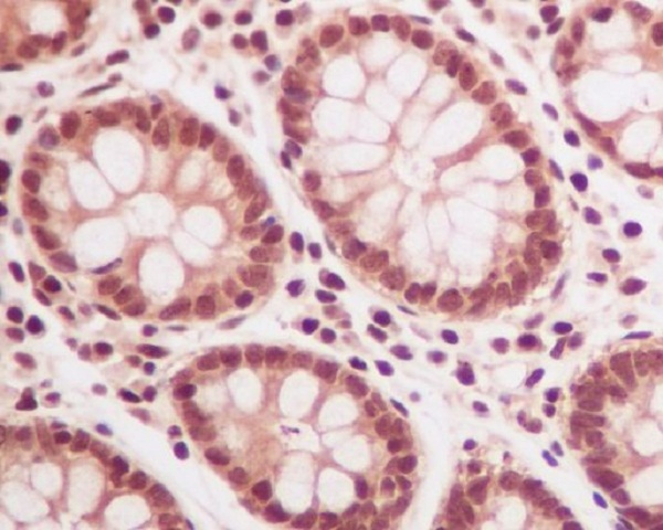 2 - Anti-Ubiquitin UBB Rabbit Monoclonal Antibody ABO13972