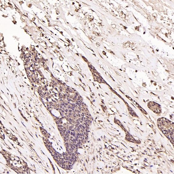 2 - Anti-Ubiquitin UBB Rabbit Monoclonal Antibody ABO13972