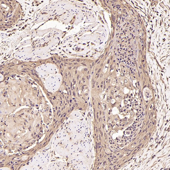 2 - Anti-Ubiquitin UBB Rabbit Monoclonal Antibody ABO13972