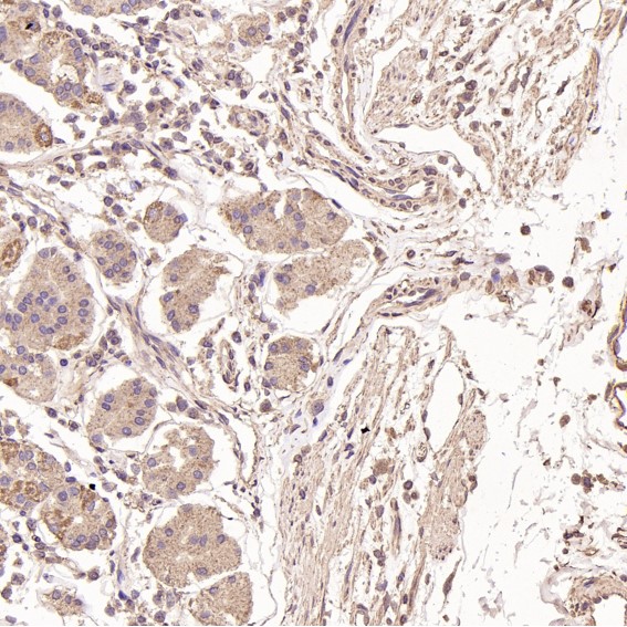 2 - Anti-Ubiquitin UBB Rabbit Monoclonal Antibody ABO13972