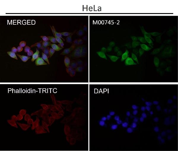 1 - Anti-Cyclin B1 CCNB1 Rabbit Monoclonal Antibody ABO13973