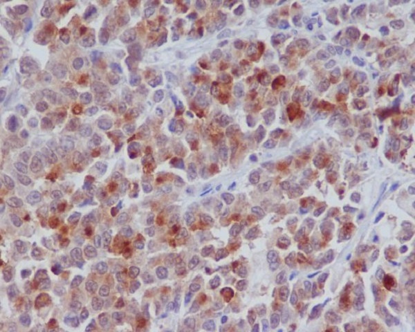 2 - Anti-Cyclin B1 CCNB1 Rabbit Monoclonal Antibody ABO13973