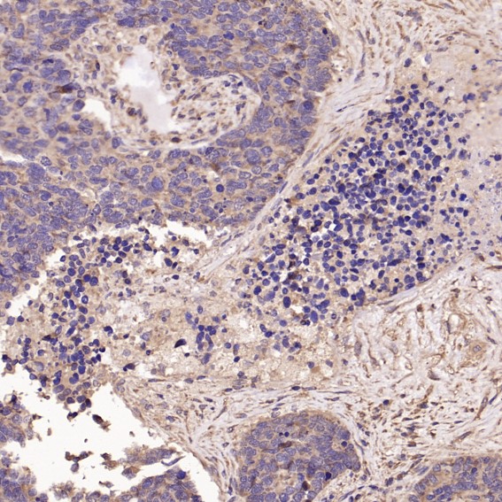 2 - Anti-Cyclin B1 CCNB1 Rabbit Monoclonal Antibody ABO13973