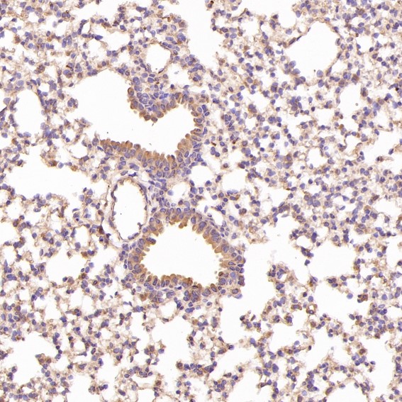 2 - Anti-Cyclin B1 CCNB1 Rabbit Monoclonal Antibody ABO13973