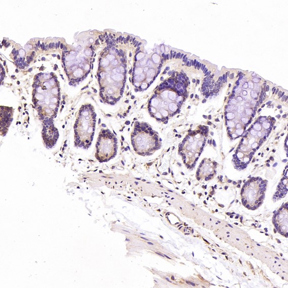 2 - Anti-Cyclin B1 CCNB1 Rabbit Monoclonal Antibody ABO13973
