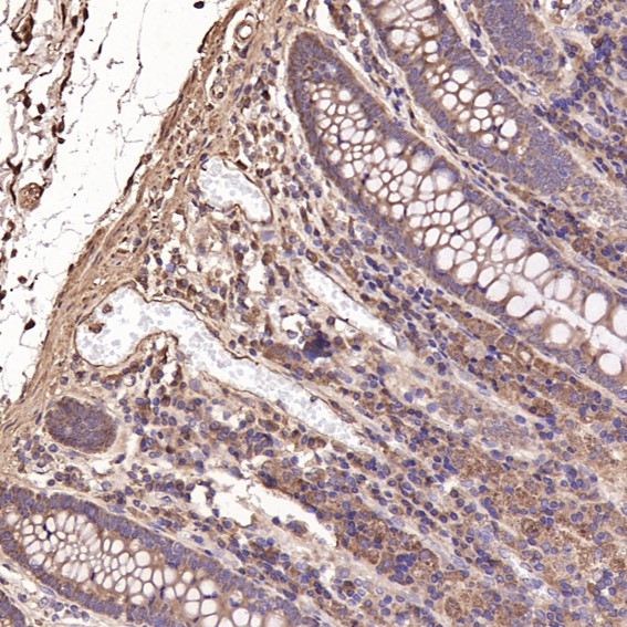 2 - Anti-Cyclin B1 CCNB1 Rabbit Monoclonal Antibody ABO13973