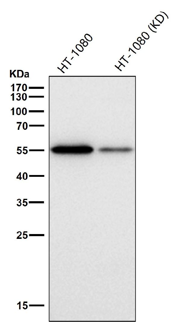 1 - Anti-Cyclin B1 CCNB1 Rabbit Monoclonal Antibody ABO13973