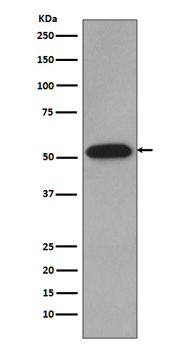 1 - Anti-Cyclin B1 CCNB1 Rabbit Monoclonal Antibody ABO13973