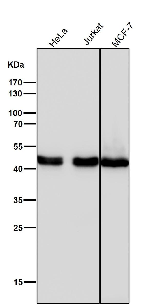 1 - Anti-Cyclin E2 CCNE2 Rabbit Monoclonal Antibody ABO13974
