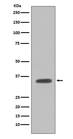 1 - Anti-Caspase-7 Casp7 Rabbit Monoclonal Antibody ABO13975