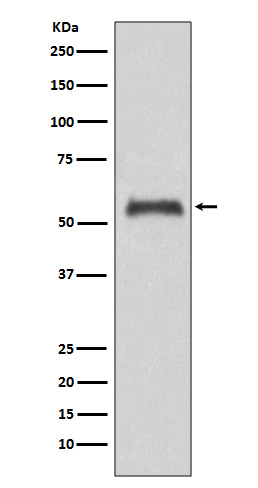1 - Anti-Caspase-8 CASP8 Rabbit Monoclonal Antibody ABO13976
