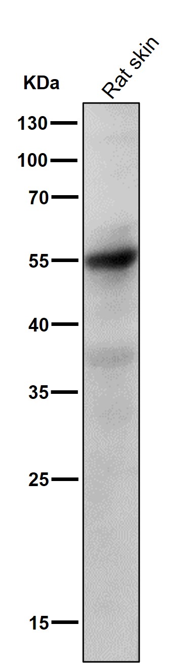 1 - Anti-Caspase-8 CASP8 Rabbit Monoclonal Antibody ABO13976