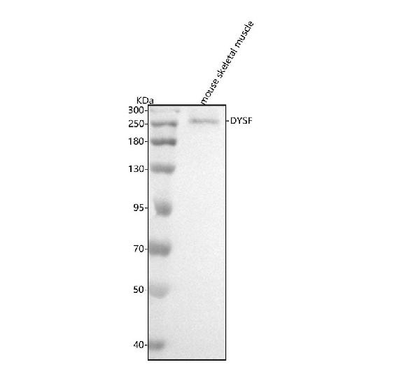 1 - Anti-Dysferlin Rabbit Monoclonal Antibody ABO13977