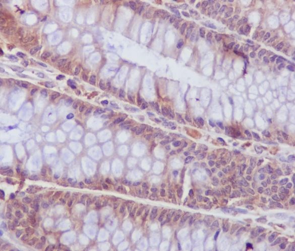 2 - Anti-Caspase-6 CASP6 Rabbit Monoclonal Antibody ABO13978