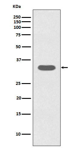 1 - Anti-Caspase-6 CASP6 Rabbit Monoclonal Antibody ABO13978
