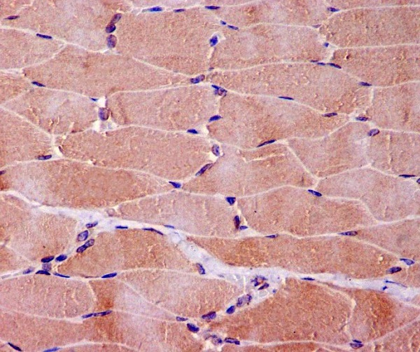 2 - Anti-Myoglobin MB Rabbit Monoclonal Antibody ABO13980