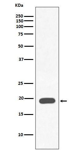 1 - Anti-Myoglobin MB Rabbit Monoclonal Antibody ABO13980