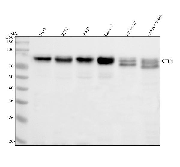 1 - Anti-Cortactin CTTN Rabbit Monoclonal Antibody ABO13981