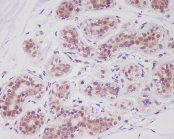 2 - Anti-Cortactin CTTN Rabbit Monoclonal Antibody ABO13981