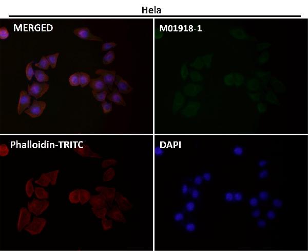 1 - Anti-IKK alpha CHUK Rabbit Monoclonal Antibody ABO13982