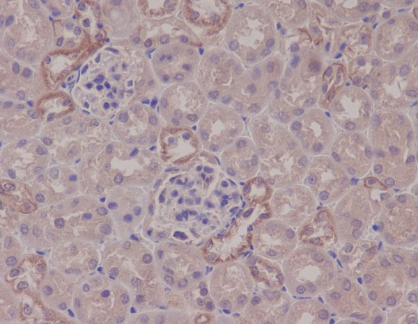 2 - Anti-IKK alpha CHUK Rabbit Monoclonal Antibody ABO13982