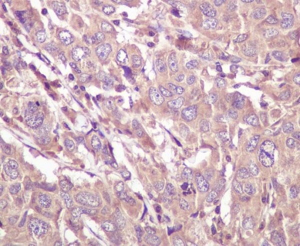 2 - Anti-Caspase 5 CASP5 Rabbit Monoclonal Antibody ABO13983