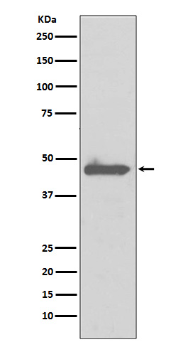 1 - Anti-Caspase 5 CASP5 Rabbit Monoclonal Antibody ABO13983