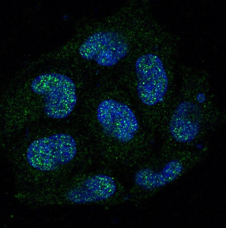 3 - Anti-Caspase-8 CASP8 Rabbit Monoclonal Antibody ABO13984