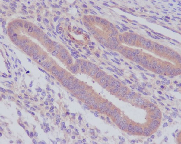 2 - Anti-Caspase-8 CASP8 Rabbit Monoclonal Antibody ABO13984