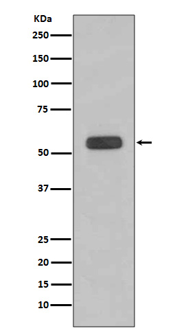 1 - Anti-Caspase-8 CASP8 Rabbit Monoclonal Antibody ABO13984
