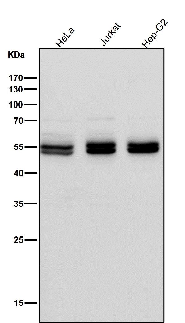 1 - Anti-Caspase-8 CASP8 Rabbit Monoclonal Antibody ABO13984