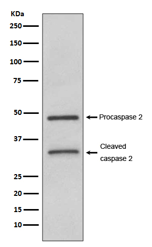 1 - Anti-Caspase-2 CASP2 Rabbit Monoclonal Antibody ABO13985