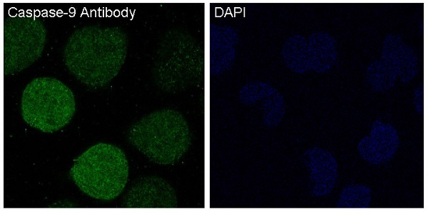 3 - Anti-Caspase-9 CASP9 Rabbit Monoclonal Antibody ABO13986