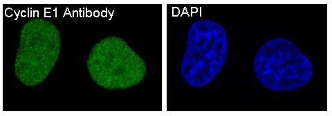 3 - Anti-Cyclin E1 CCNE1 Rabbit Monoclonal Antibody ABO13987