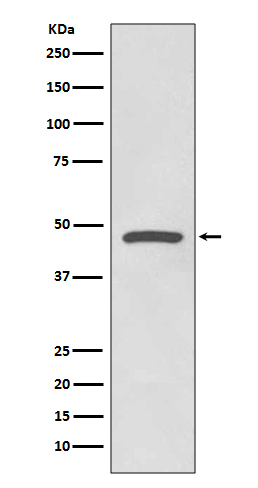 1 - Anti-Cyclin E1 CCNE1 Rabbit Monoclonal Antibody ABO13987