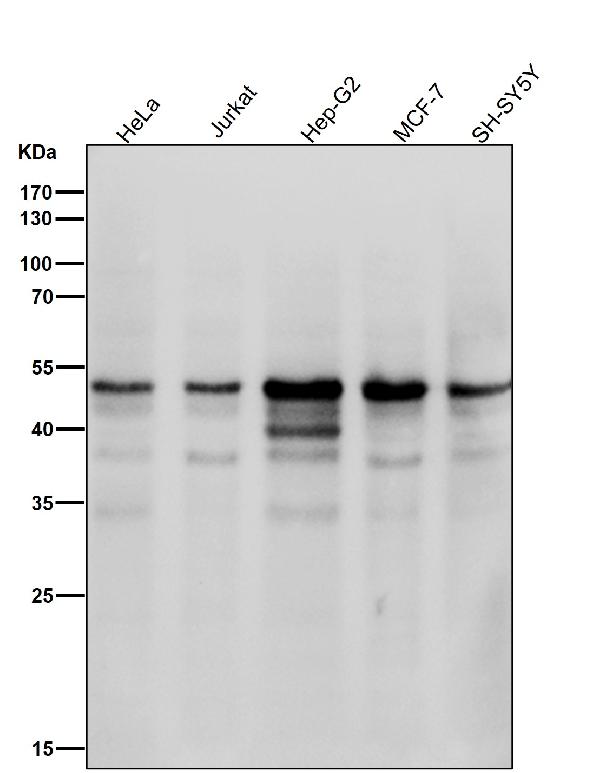 1 - Anti-Cyclin E1 CCNE1 Rabbit Monoclonal Antibody ABO13987