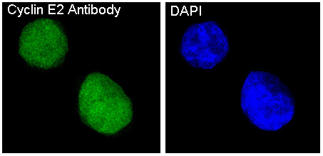 3 - Anti-Cyclin E2 CCNE2 Rabbit Monoclonal Antibody ABO13988