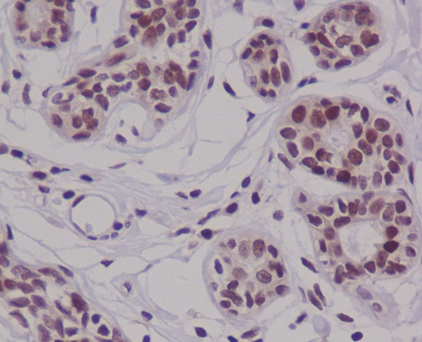 2 - Anti-Cyclin E2 CCNE2 Rabbit Monoclonal Antibody ABO13988