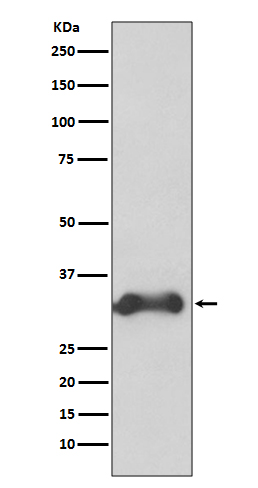 1 - Anti-Cyclin D3 CCND3 Rabbit Monoclonal Antibody ABO13989