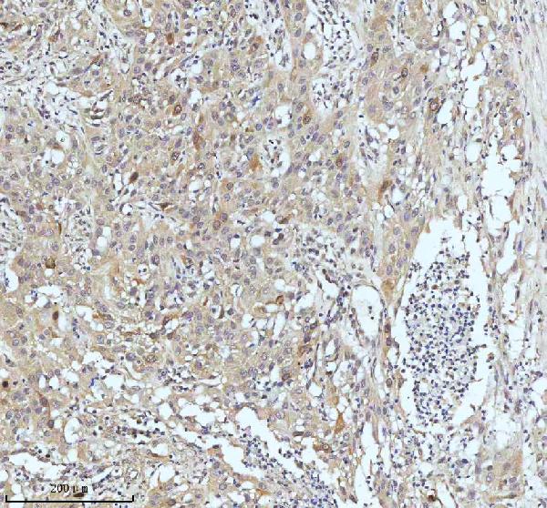 2 - Anti-Cyclin B2 CCNB2 Rabbit Monoclonal Antibody ABO13990