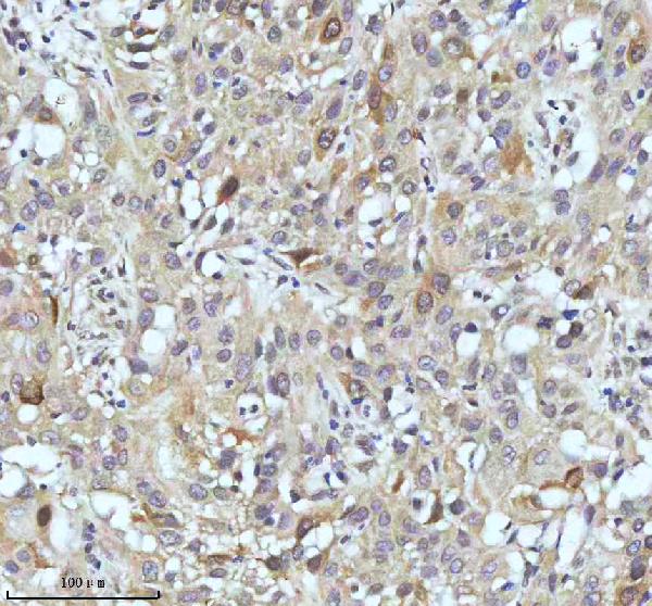 2 - Anti-Cyclin B2 CCNB2 Rabbit Monoclonal Antibody ABO13990