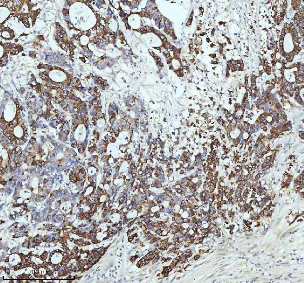 2 - Anti-Cyclin B2 CCNB2 Rabbit Monoclonal Antibody ABO13990