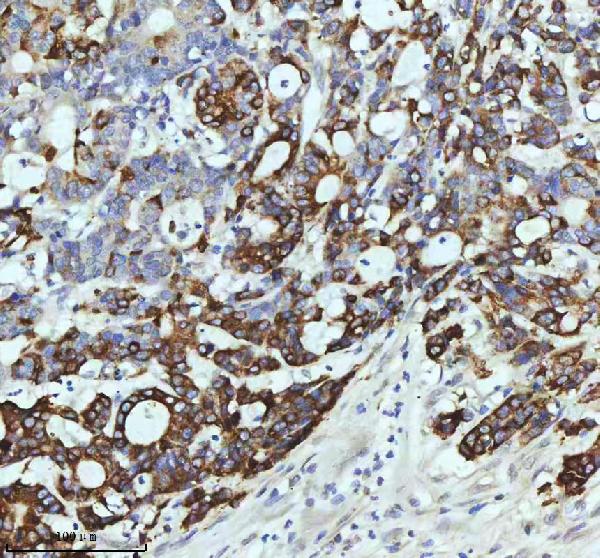 2 - Anti-Cyclin B2 CCNB2 Rabbit Monoclonal Antibody ABO13990